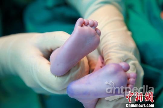 世界首例“线粒体移植婴儿”广州出院