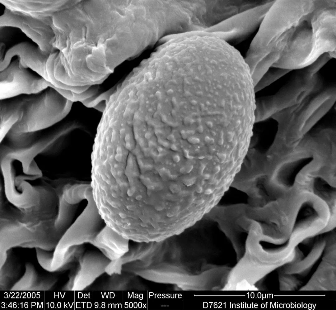 电镜下的真菌孢子(图片来源:中国科学院微生物研究所)