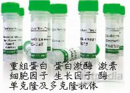 MouseAntiHumanEotaxin-1(CCL11)