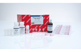 QIAGEN RNeasy Lipid Tissue Mini Kit