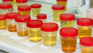 毒品分析自动化｜快速测定尿样中的氯胺酮和脱氢去甲氯胺酮
