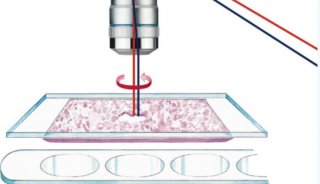 空间脂质组学—激光显微切割质谱联用技术助力脑组织微区研究