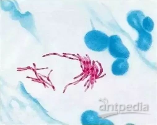 结核杆菌怎么画图片