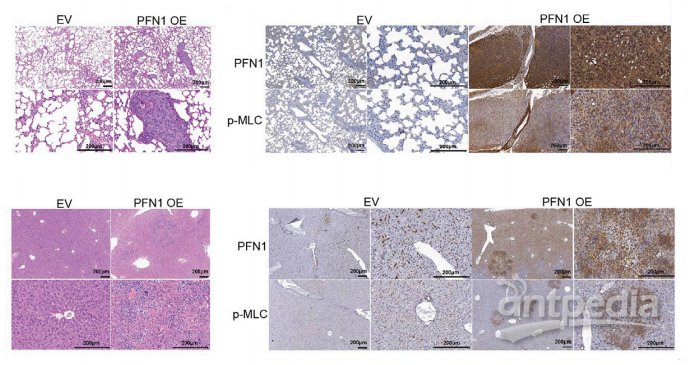 图6. HE染色小鼠模型肺组织的代表性图像/肺组织中PFN1和p-MLC表达