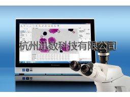 迅数MCN 2红细胞微核智能分析系统