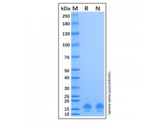 Recombinant Human beta Catenin Protein，無載體, ≥90%(SDS-PAGE), 見COA 