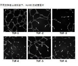 诱导HUVEC血管形成