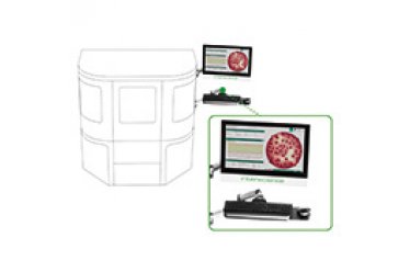菌落计数器interscience Scanstation100