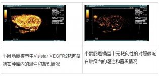 靶向微泡介导的<em>超声</em>分子<em>诊断</em>