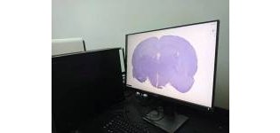 病理数字切片扫描