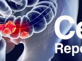 Cell Reports | 复旦大学胡维国课题组4D蛋白组揭示细胞内补体C5a/C5aR1信号调控结直肠癌发生新机制