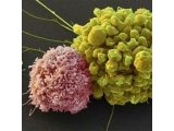 CAR-T细胞治疗靶点现状以及新靶点挖掘