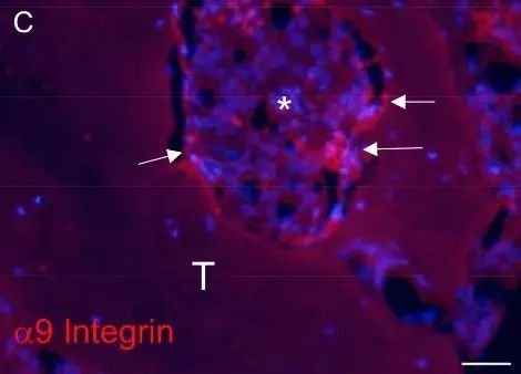 Cancer Res 胞外蛋白为前列腺癌骨转移营造微环境 微信文章 仪器谱
