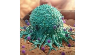 文献分享 | 基于血浆蛋白组学的泛癌诊断模型