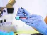 ( 2021 版)色谱技术用于治疗药物监测质量保证的专家共识