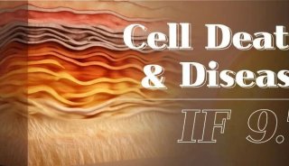 Cell Death & Disease（IF 9.7）| 转录组+5D蛋白质组学助力国内团队类器官模型评价及药物筛选