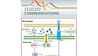 Nature Communications | 氨基酸异常摄取促进肿瘤免疫逃逸