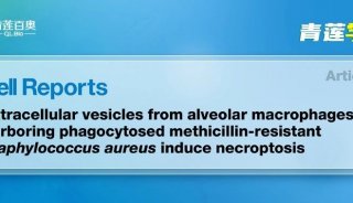 Cell Rep項(xiàng)目文章 | 浙江大學(xué)醫(yī)學(xué)院第二附屬醫(yī)院研究團(tuán)隊(duì)揭示MRSA肺炎發(fā)病機(jī)制和潛在治療靶點(diǎn)