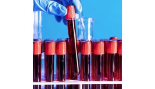 单细胞测序专题——血液篇