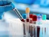 TDM实战| 二维液相色谱法用同一体系测定血清中抗真菌药物伏立康唑的案例分享