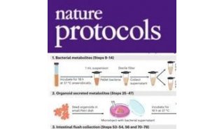Nature Protocols | “肠-脑轴”靶向代谢组学研究--如何破局？