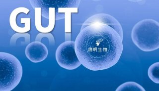 GUT | 国家癌症中心崔巍联合多组学技术团队发表血清代谢组肠癌早筛新机制