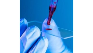单细胞测序样本制备系列——血液样本制备