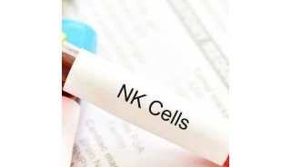 NK细胞疗法生产工艺探索