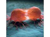 淋巴瘤诊断免疫组织化学染色抗体选择